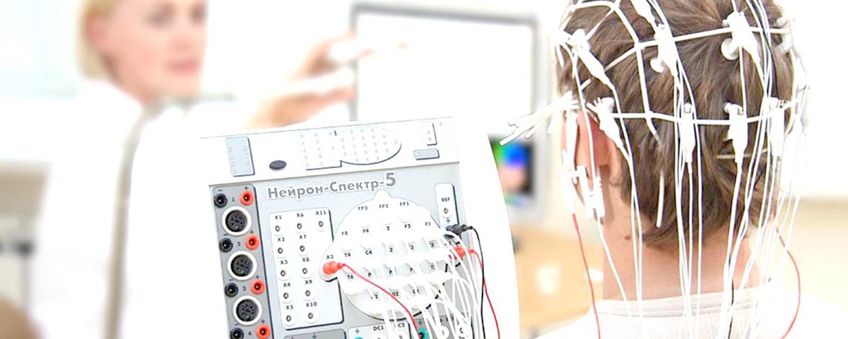 Diagnóstico Epilepsia