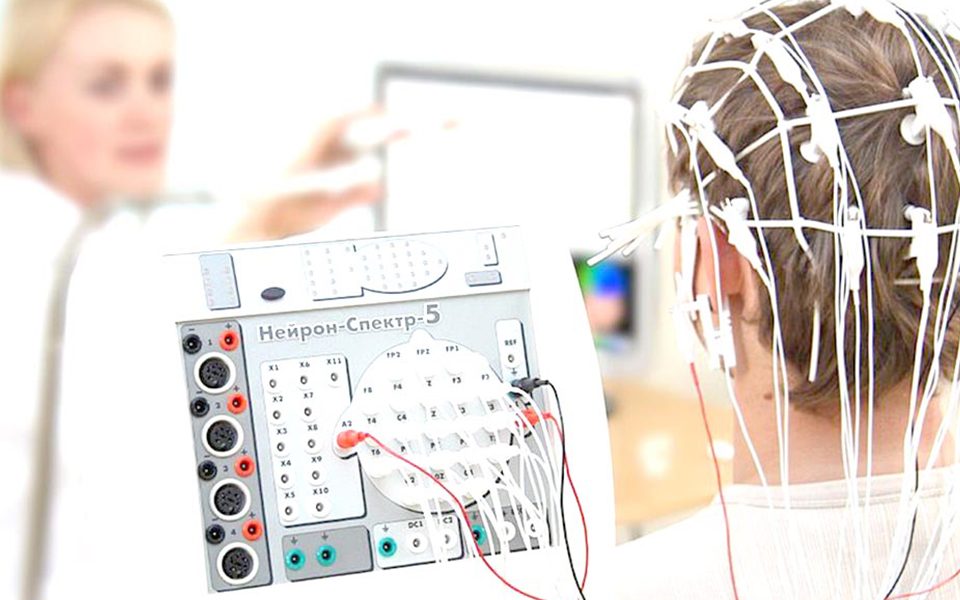 Diagnóstico Epilepsia